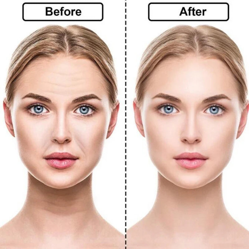16Pcs Face Patches anti Rimpel Pads anti Wrinkle Removal Sticker Face Forehead Neck Eye Sticker Skin Care Patch